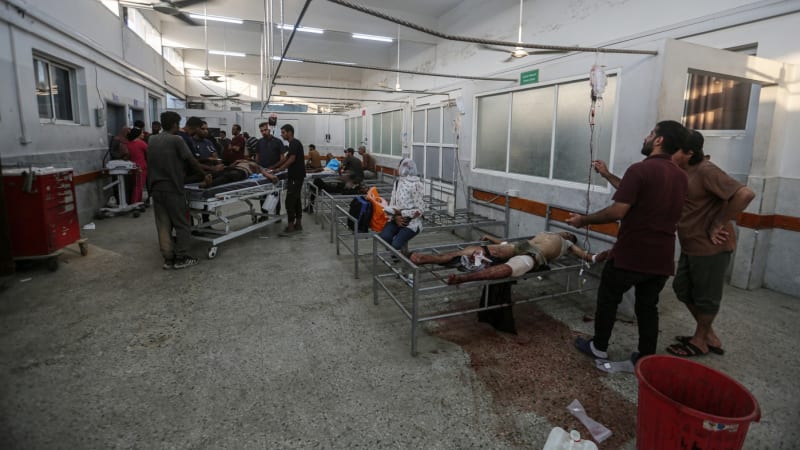 Smutná realita Gazy: Lékaři operují těžce zraněné i bez anestetik. Smrt je všude, líčí místní